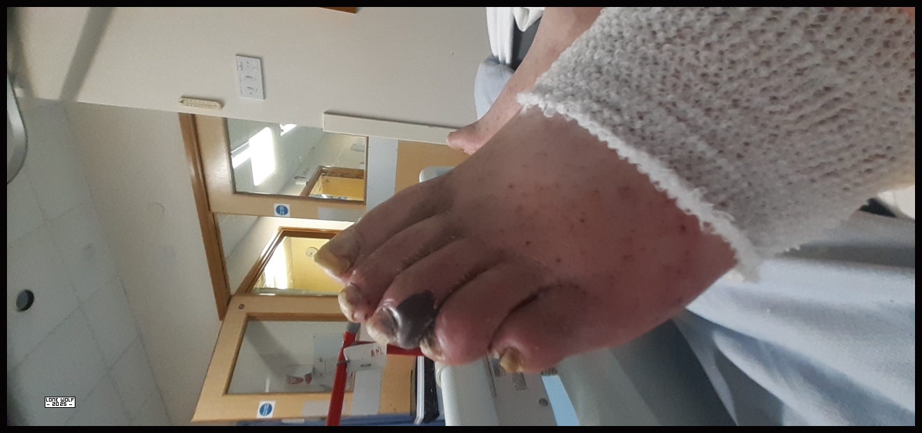Not a happy toe.
